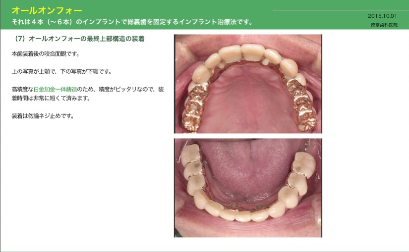 スクリーンショット（2015-10-01 15.55.04）.jpg